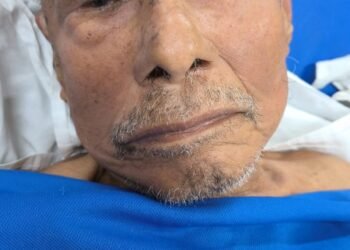 HPS João Lúcio pede ajuda para localizar familiares do paciente Fábio Pinheiro, de 75 anos