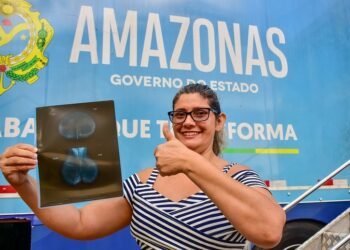 Governo do Amazonas oferece cirurgias ginecológicas e exames para mais de mil mulheres, neste fim de semana