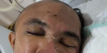 HPS João Lúcio solicita apoio para identificar familiares de paciente internado