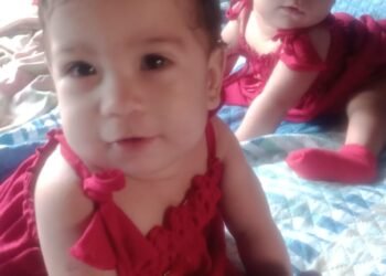 Siamesas que nasceram na maternidade Ana Braga completam um ano e atestam avanço da saúde no Amazonas