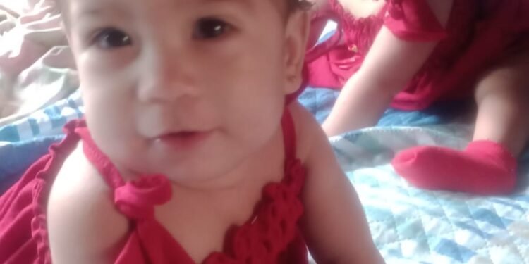 Siamesas que nasceram na maternidade Ana Braga completam um ano e atestam avanço da saúde no Amazonas