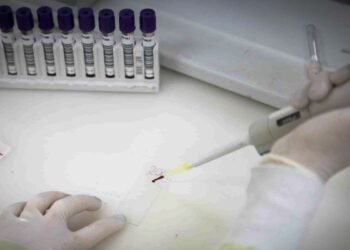 Paciente em SP com suspeita de ebola testa positivo para meningite