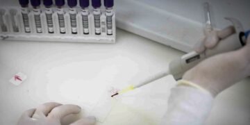 Paciente em SP com suspeita de ebola testa positivo para meningite