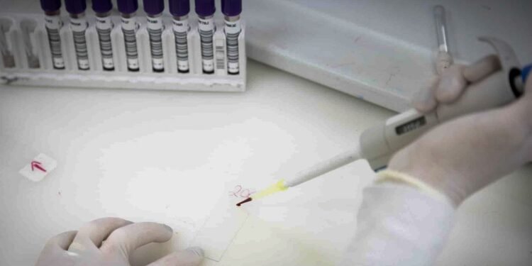 Paciente em SP com suspeita de ebola testa positivo para meningite
