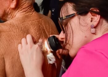 Programa Dermato Saúde, do Governo do Amazonas, chega a Itapiranga