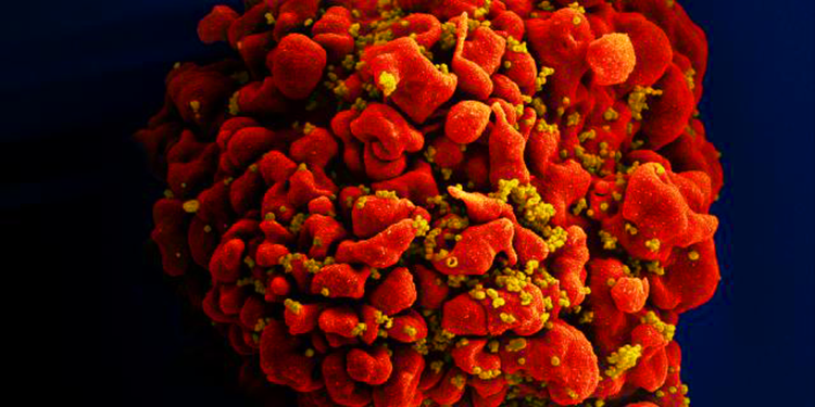Dois novos casos de possível cura do HIV são anunciados; total chega a 13 no mundo